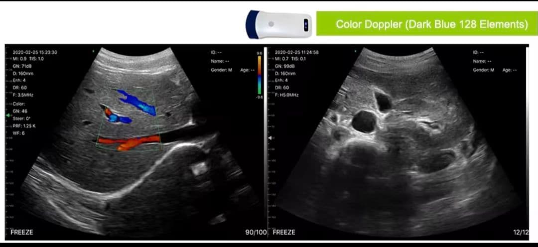 【極美品】ワイヤレスポータブルエコー　ドップラー搭載・3 in 1ハイブリッド