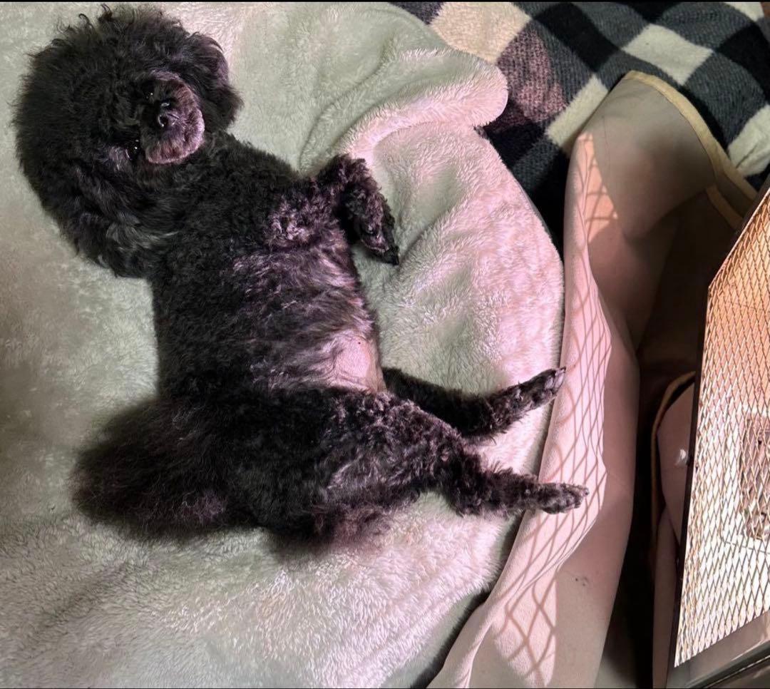 光線治療　サナモアジョイントカーボン　１０箱